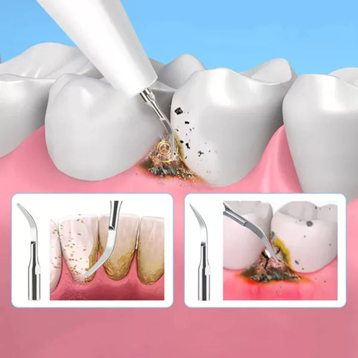 Verktøy for fjerning av tannstein og plakk